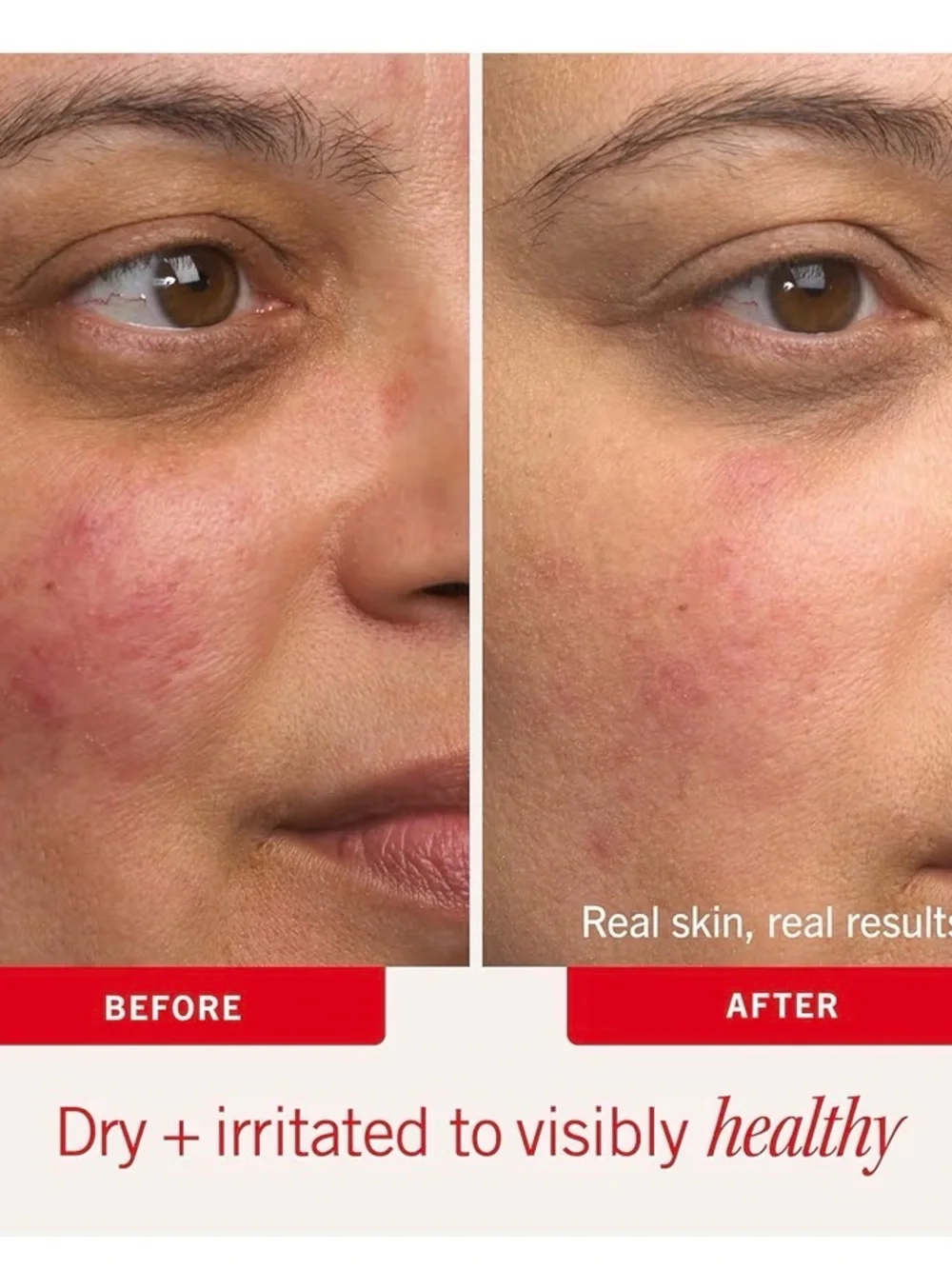 First Aid Beauty Ultra Repair Cream White with Red Text - Picture 5 of 13
